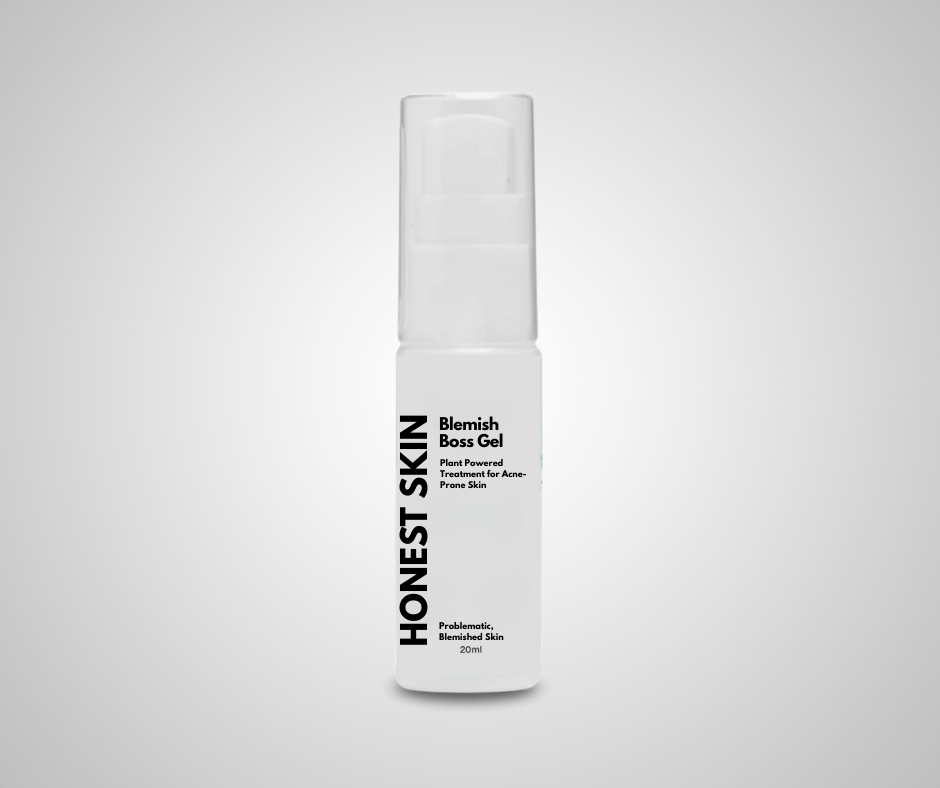 Blemish Boss Gel: Plant-Powered Treatment for Acne-Prone Skin